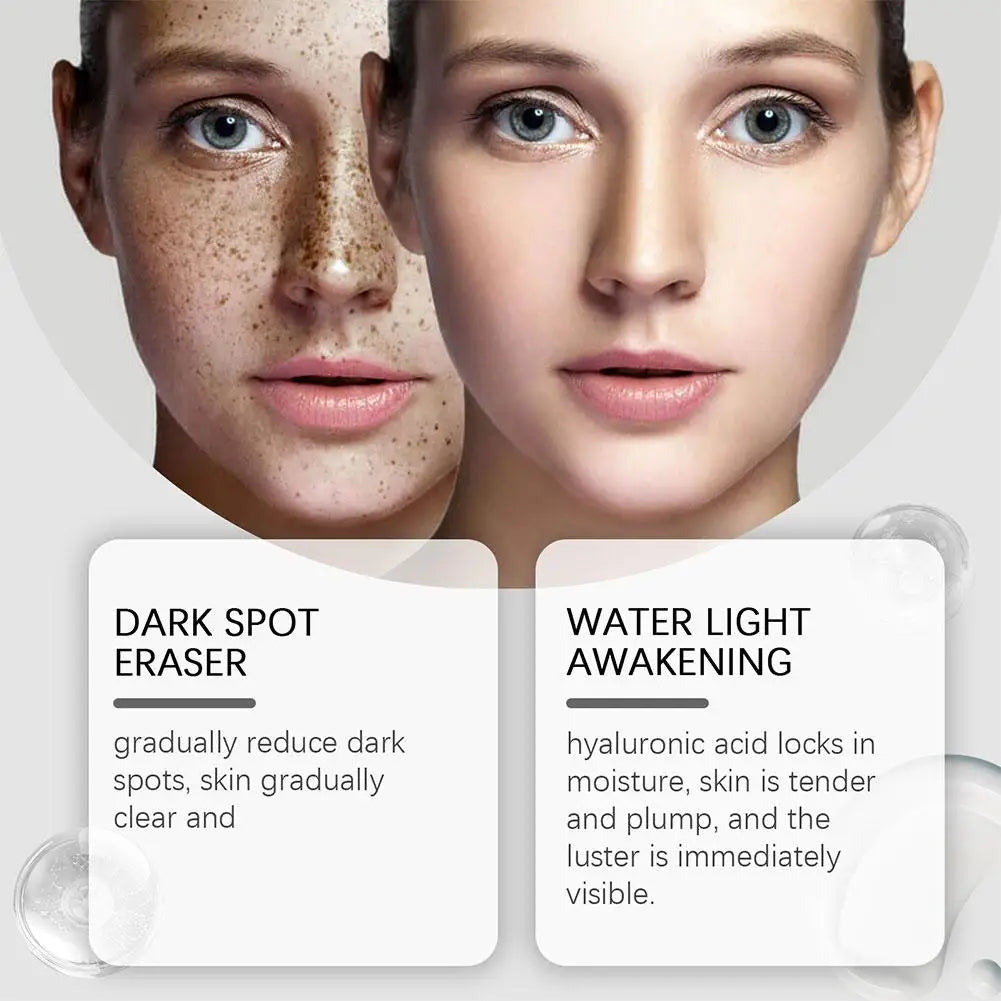 30ml Dark Spot Corrector