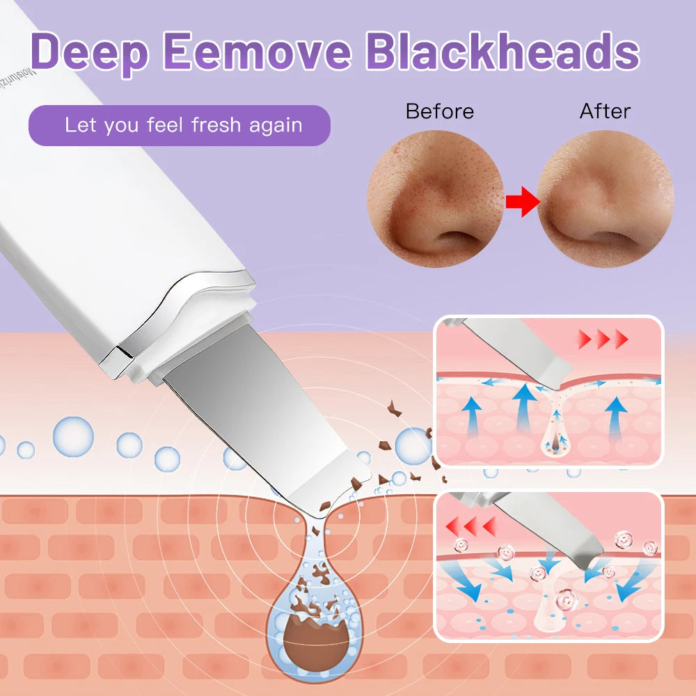 Electric Ultrasonic Skin Scrubber Face Spatula