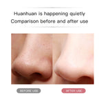 Electric Ultrasonic Skin Scrubber Face Spatula