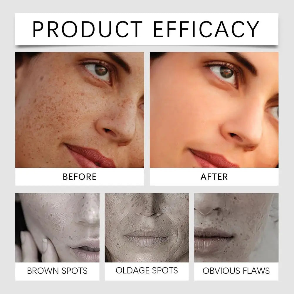 30ml Dark Spot Corrector
